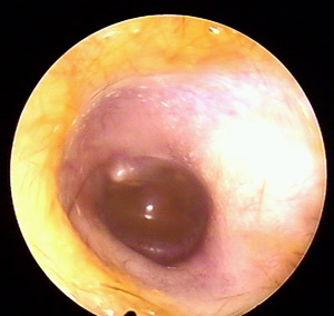 ���ڶ�����ŧ���ݺ���!!