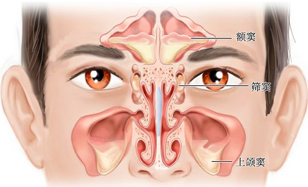 教授解析:鼻息肉最佳治疗方法