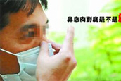 家长必知 小孩鼻出血的主要症状